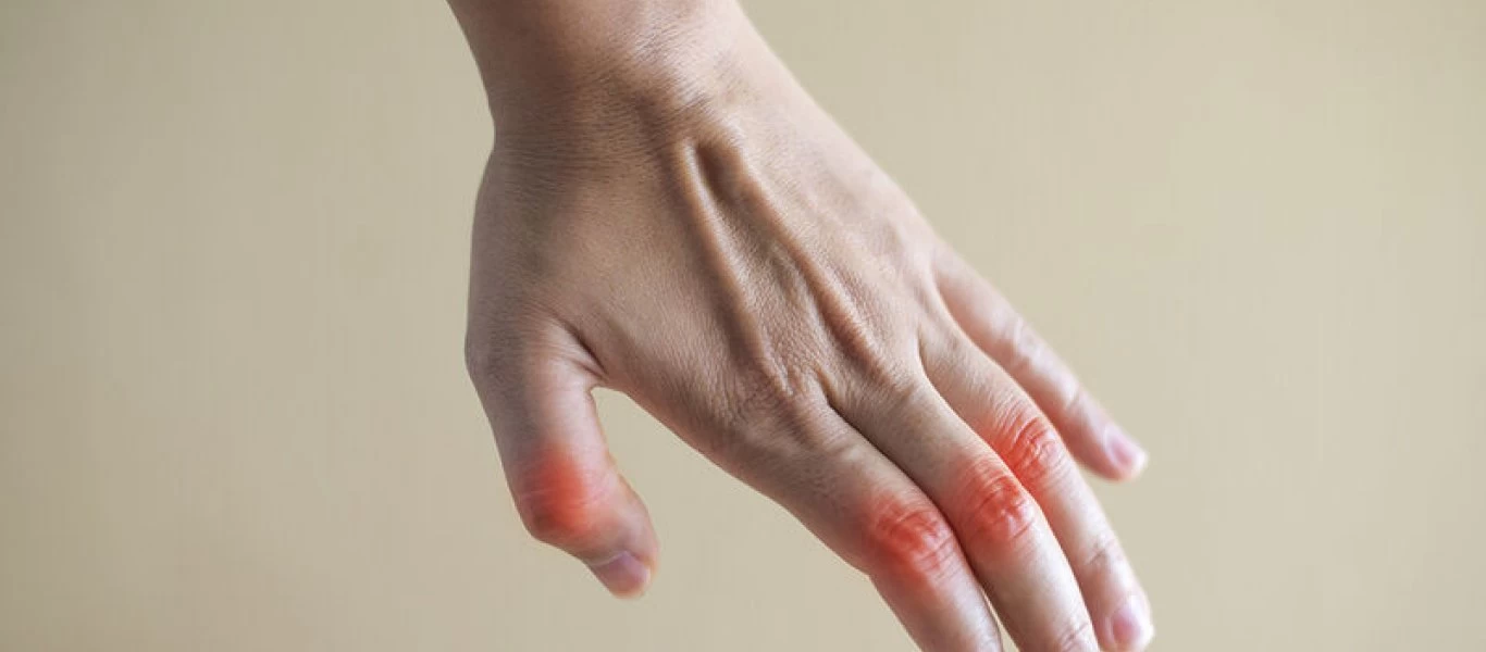 Κι όμως η θεραπεία της αρθρίτιδας βρέθηκε στη... φύση